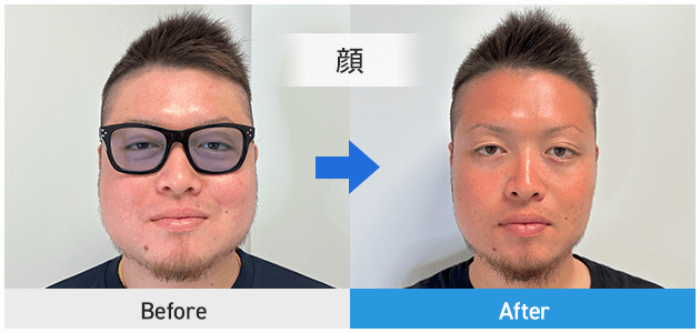 顔