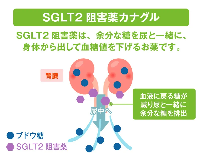 SGLT2阻害薬カナグルの特徴と効果