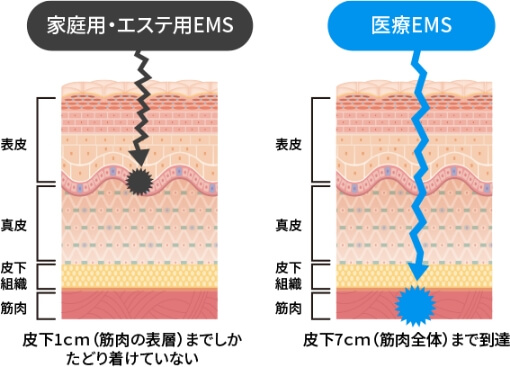 医療電磁場EMS