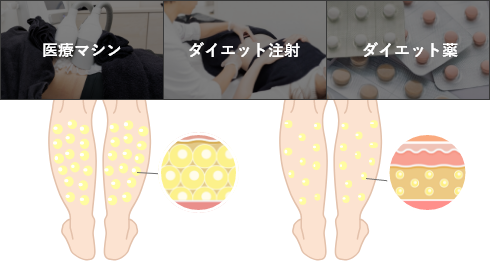 医療マシン ダイエット注射 ダイエット薬