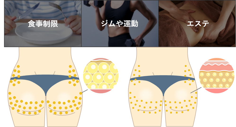 食事制限 ジムや運動 エステ