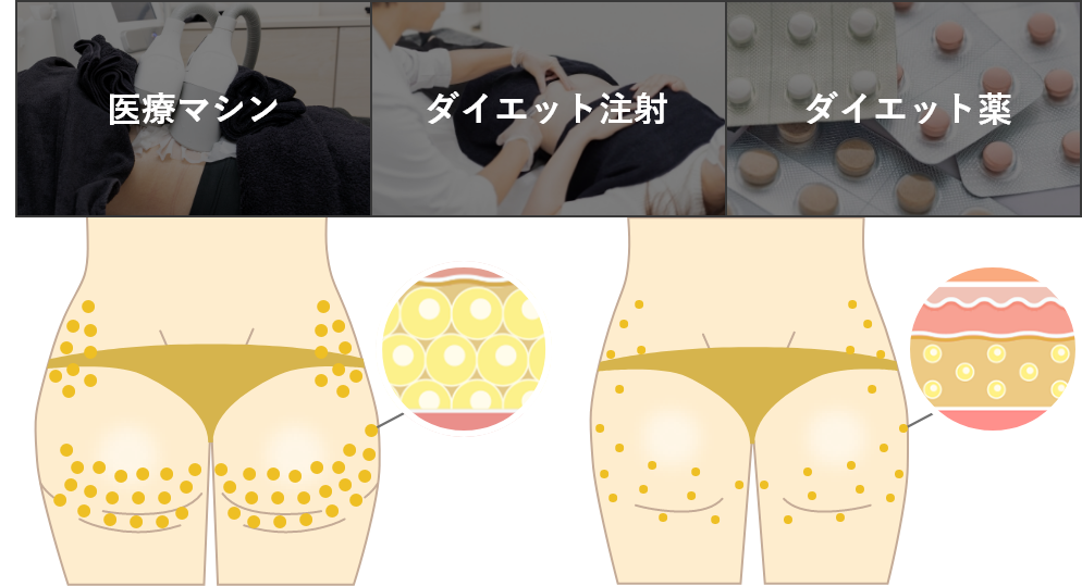 医療マシン ダイエット注射 ダイエット薬