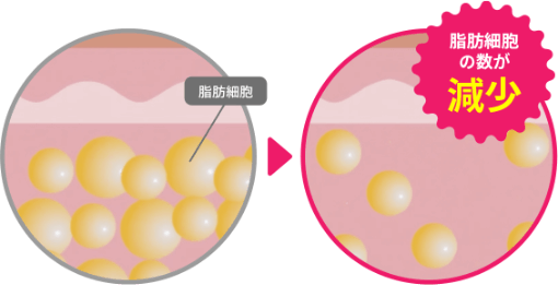 脂肪に直接アプローチして破壊・分解02