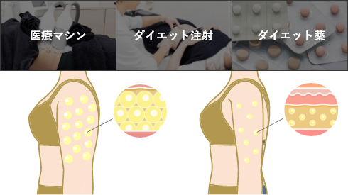 医療マシン ダイエット注射 ダイエット薬