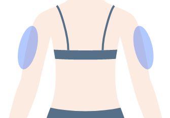 画像：二の腕痩せスタンダード２エリア